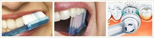 牙齿清洁2.jpg