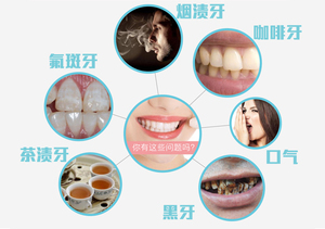 不同的牙齿问题与形成的原因，识别牙齿问题有妙招