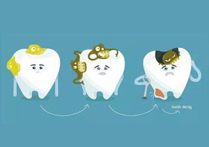 日常行为导致蛀牙的原因