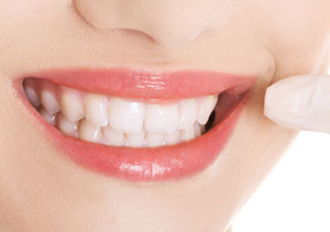 黄牙可以分成哪几种类？
