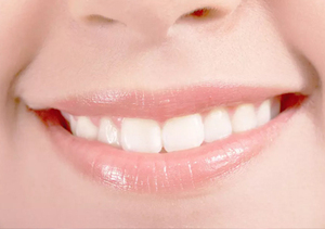 牙黄是颜值的一大杀手，如何对付它？