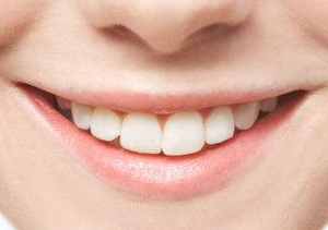 牙齿美白切勿盲目 以免损伤我们健康的牙齿